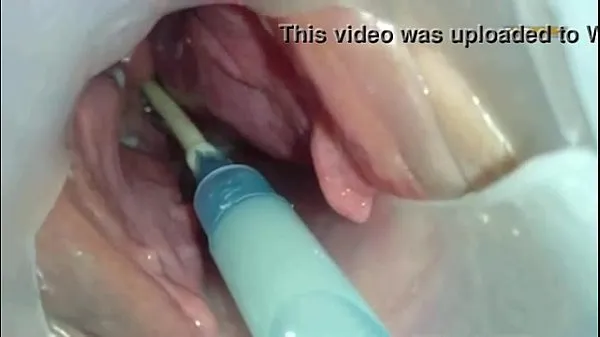 HD Sperm injected into the uterus of the wife of others mega Tube