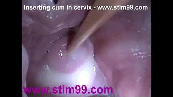 HD Insertion Semen Cum in Cervix Wide Stretching Pussy Speculum mega tuba