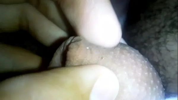 HD Would they fuck their penis like that? Fordyce glands (not disease) nor contagious 메가 튜브