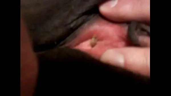HD Maggot entering black woman's urethra เมกะทูป
